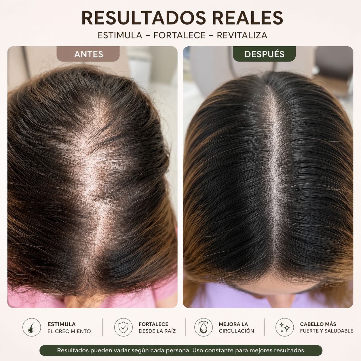 Cepillin - el cepillo que cuida tu cabello desde la raiz