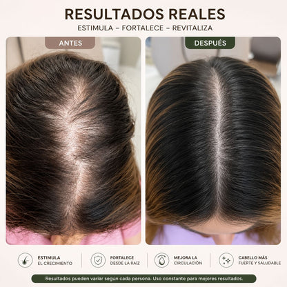 Cepillin - el cepillo que cuida tu cabello desde la raiz